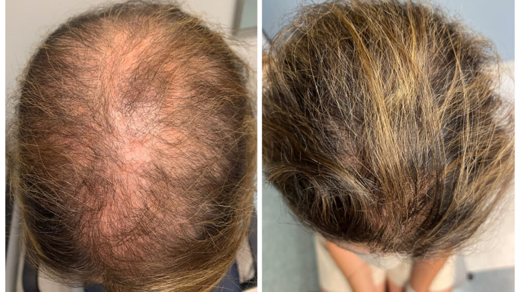 before-and-after-hair-treatment