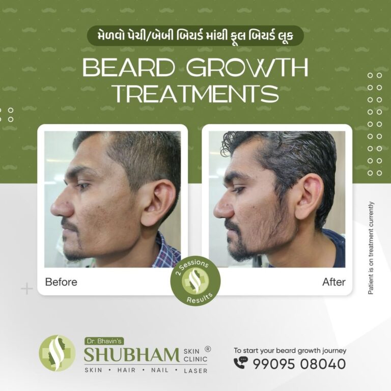 hair-transplant-treatment-man-PRP-Therapy-Hair-Loss-Treatment