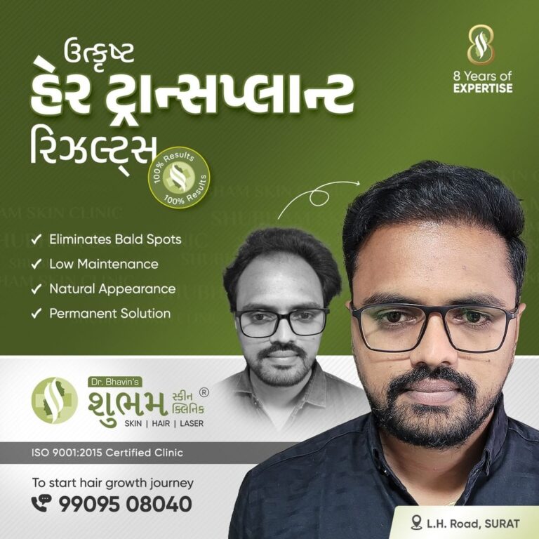 hair-transplant-treatment-man-PRP-Therapy-Hair-Loss-Treatment