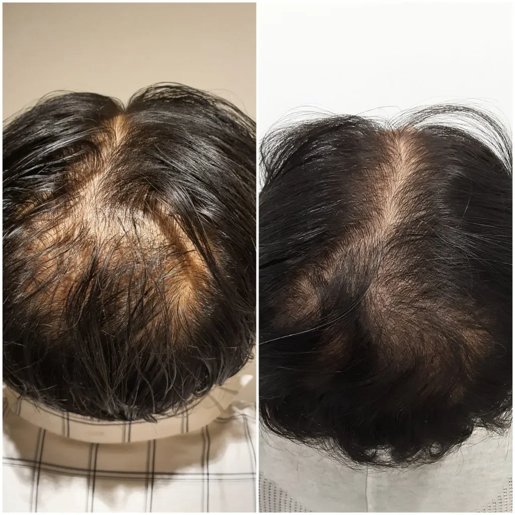 before-and-after-hair-treatment
