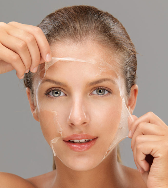 chemical-peels-Result-Of-Chemical-Peeling