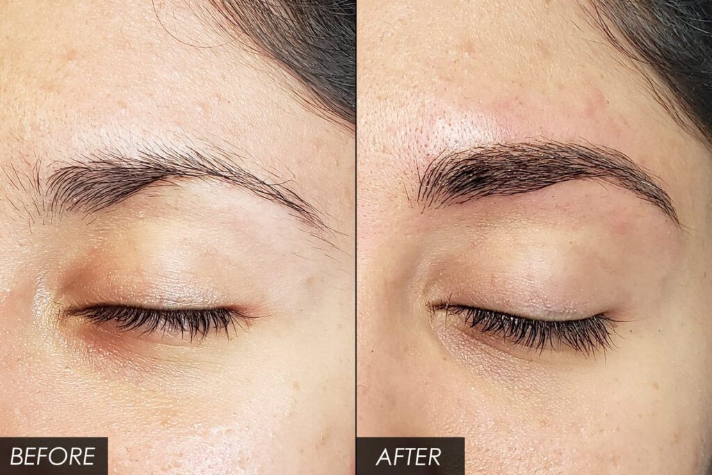microblading-before-and-after